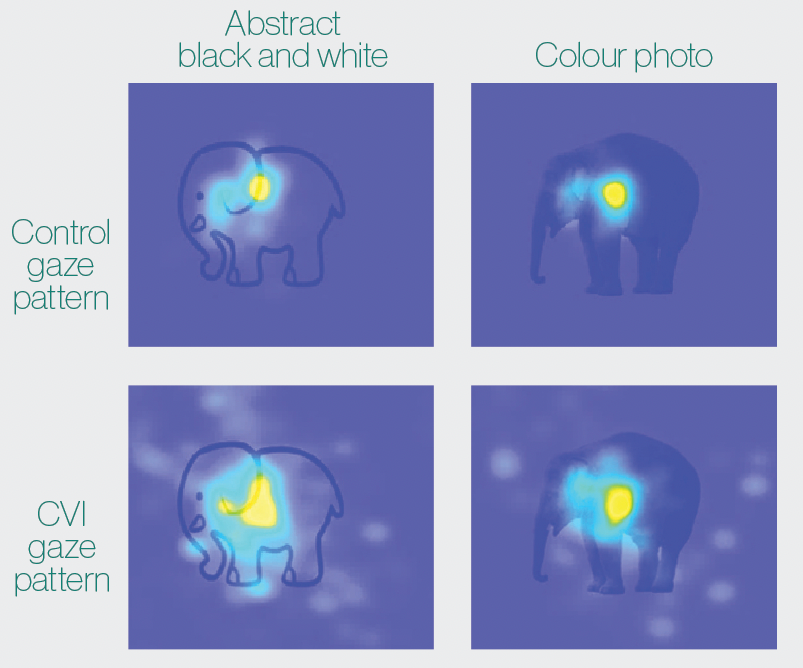 Four heat maps show the fixation points of images viewed by patients with and without cerebral visual impairment. 