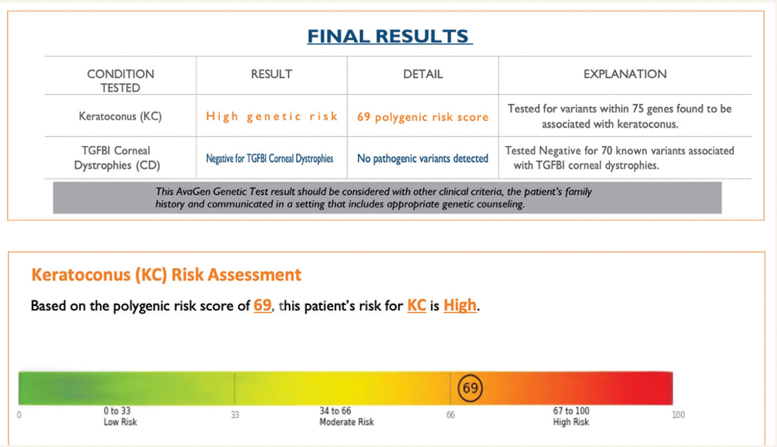 Figure 1. Results from 32-year-old patient. Genetic testing for keratoconus facilitates earlier recognition of condition