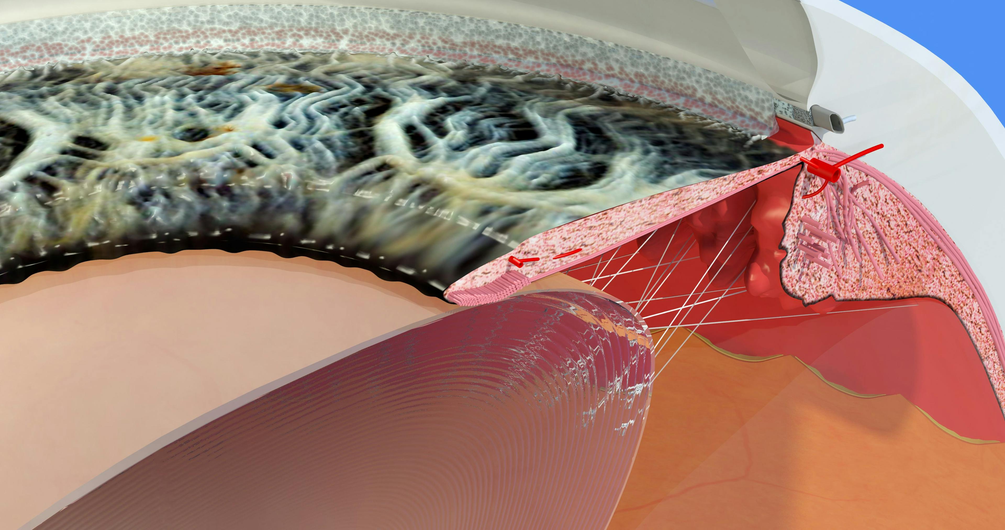 Understanding Schlemm canal to improve the results of stent surgery