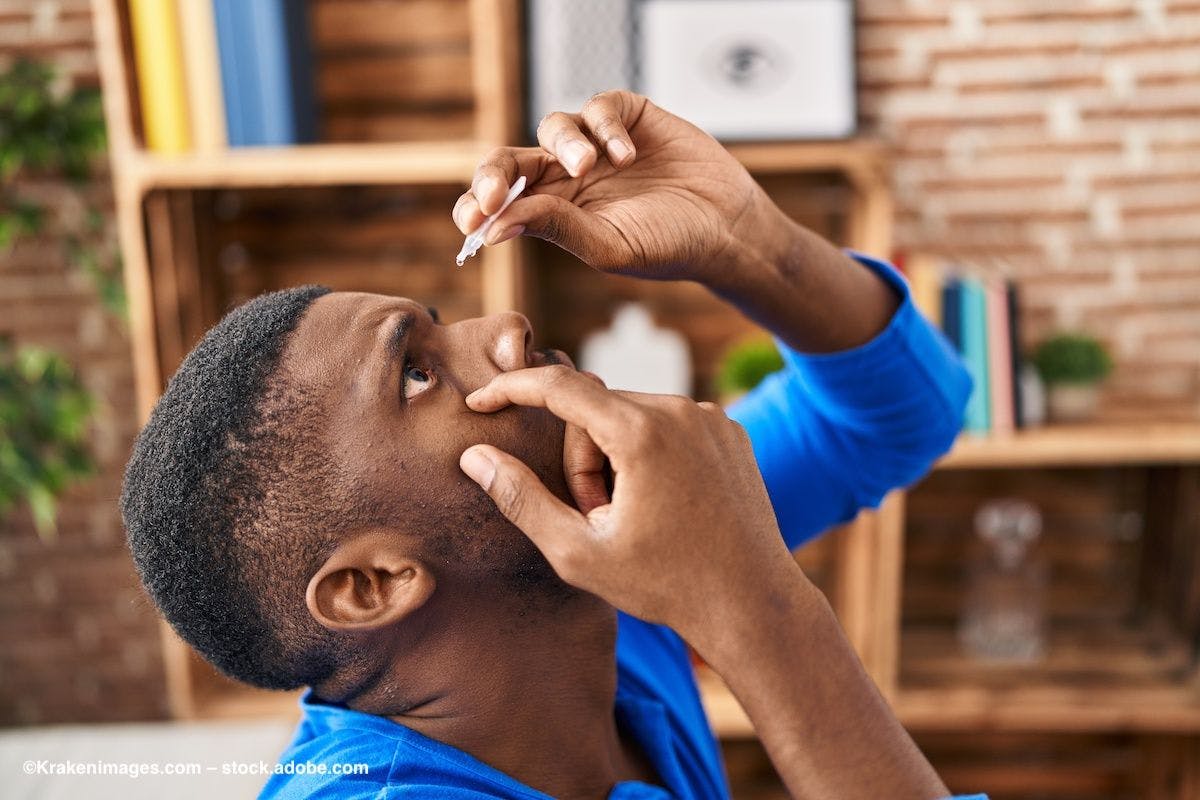 A patient administers eye drops to his own eye. Image credit: ©Krakenimages.com – stock.adobe.com