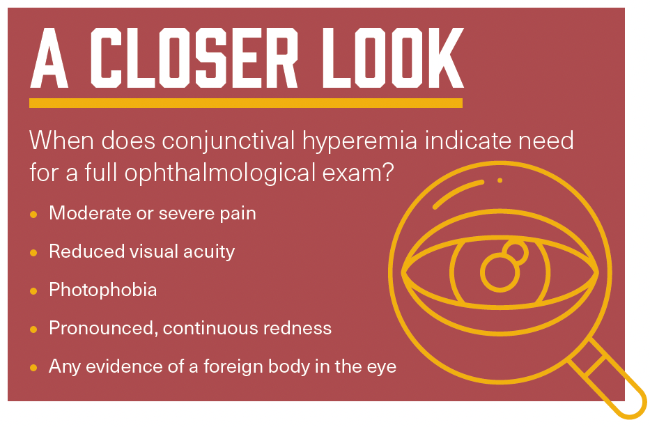 A graphic titled, "A CLOSER LOOK." The text reads as follows: "When does conjunctival hyperemia indicate need for a full ophthalmological exam? Moderate or severe pain; Reduced visual acuity; Photophobia; Pronounced, continuous redness; Any evidence of a foreign body in the eye"