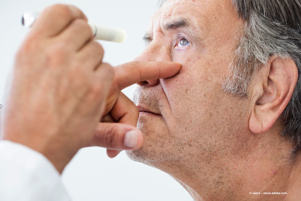 A man undergoes an eye exam. An ophthalmologist shines a light into his eye. Image credit: ©sebra – stock.adobe.com