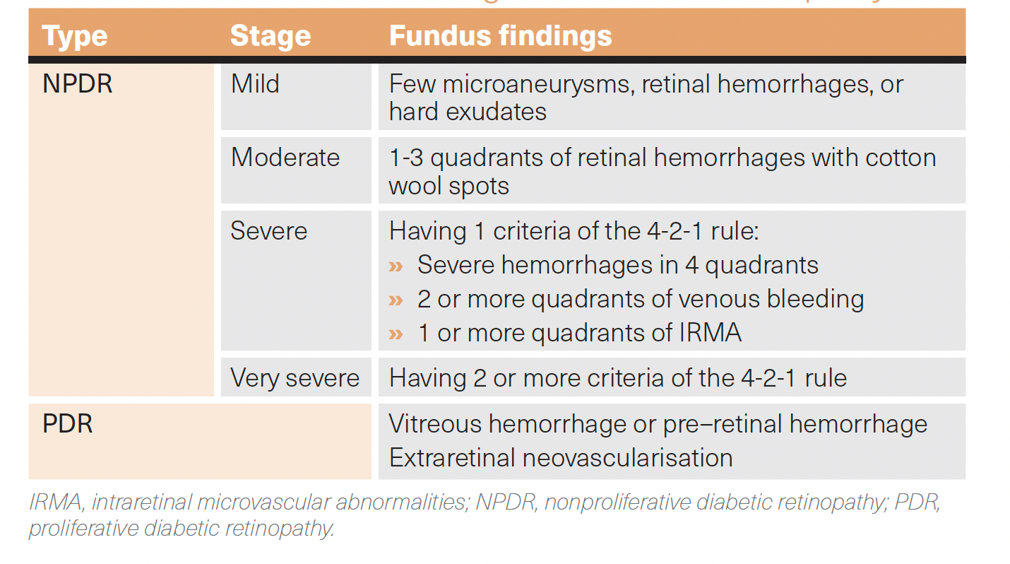 A table showing classification and stages of diabetic retinopathy.