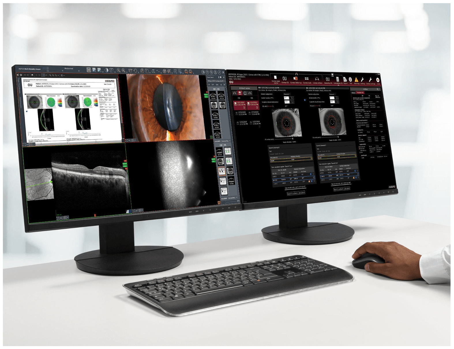 Image 1 — Multimodality Viewer showcasing a comprehensive cataract workflow overview