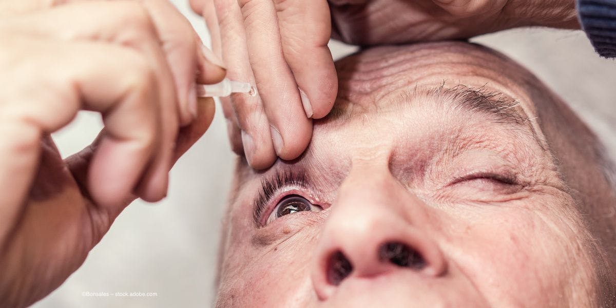 An elderly person self-administers an eye drop. Image credit: ©Bonsales – stock.adobe.com