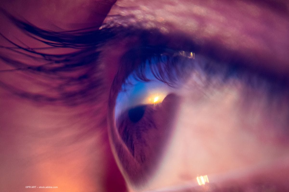 A close-up of an eye with light reflecting in the iris and the pupil.  Image credit: ©PR ART – stock.adobe.com