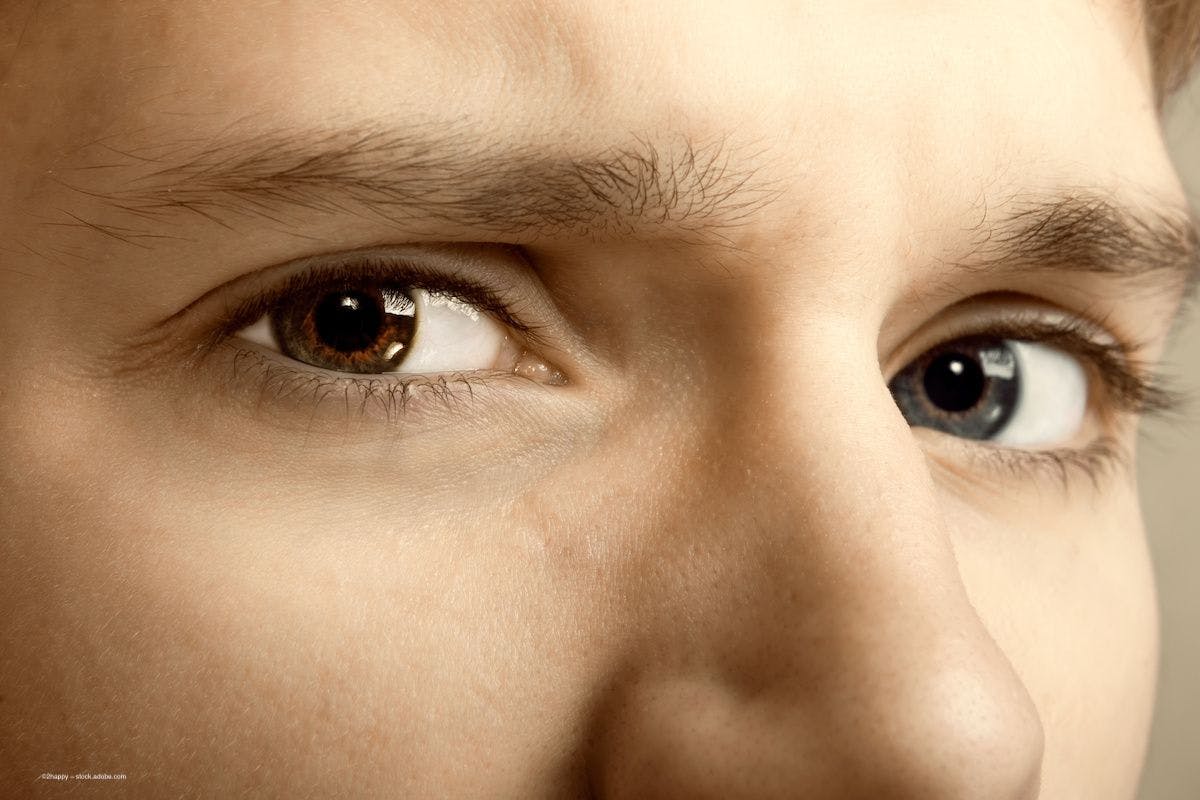 A young man stares at the camera in close-up. He has one brown eye and one blue eye. Image credit: ©2happy – stock.adobe.com