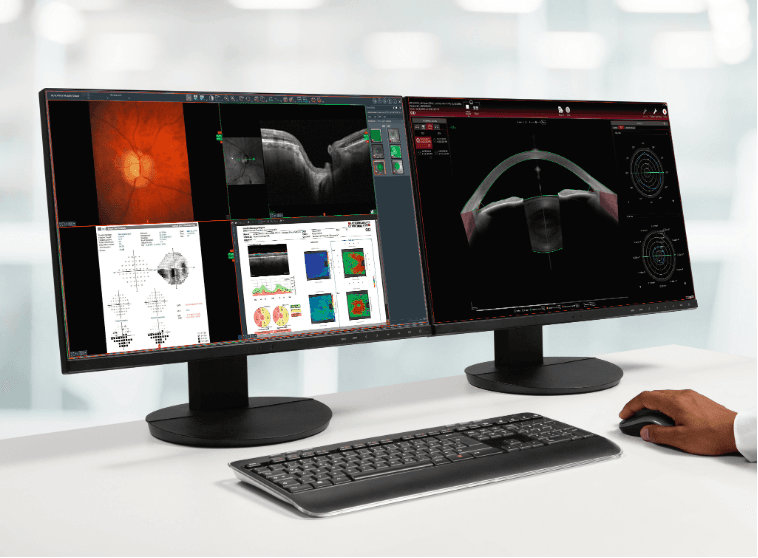 HEYEX 2 Multimodality Viewer (MMV) dashboard with SPECTRALIS GMPE image and Hood Glaucoma Report plus third party visual field report and fundus image side by side with ANTERION clinical viewer.