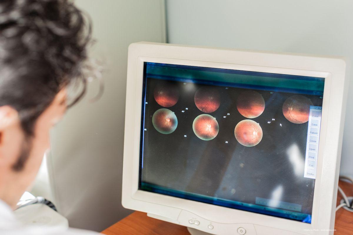 A clinician looks at a retinal scan. Image credit: ©Dario Lo Presti – stock.adobe.com