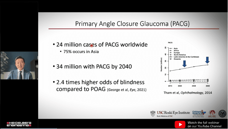 This highlights video details the key aspects of Primary Angle Closure Glaucoma. Watch the full recorded webinar to learn more about innovative interventions that improve angle closure glaucoma care:
Transforming Angle Closure Care Using OCT and AI I ANTERION (heidelbergengineering.com)