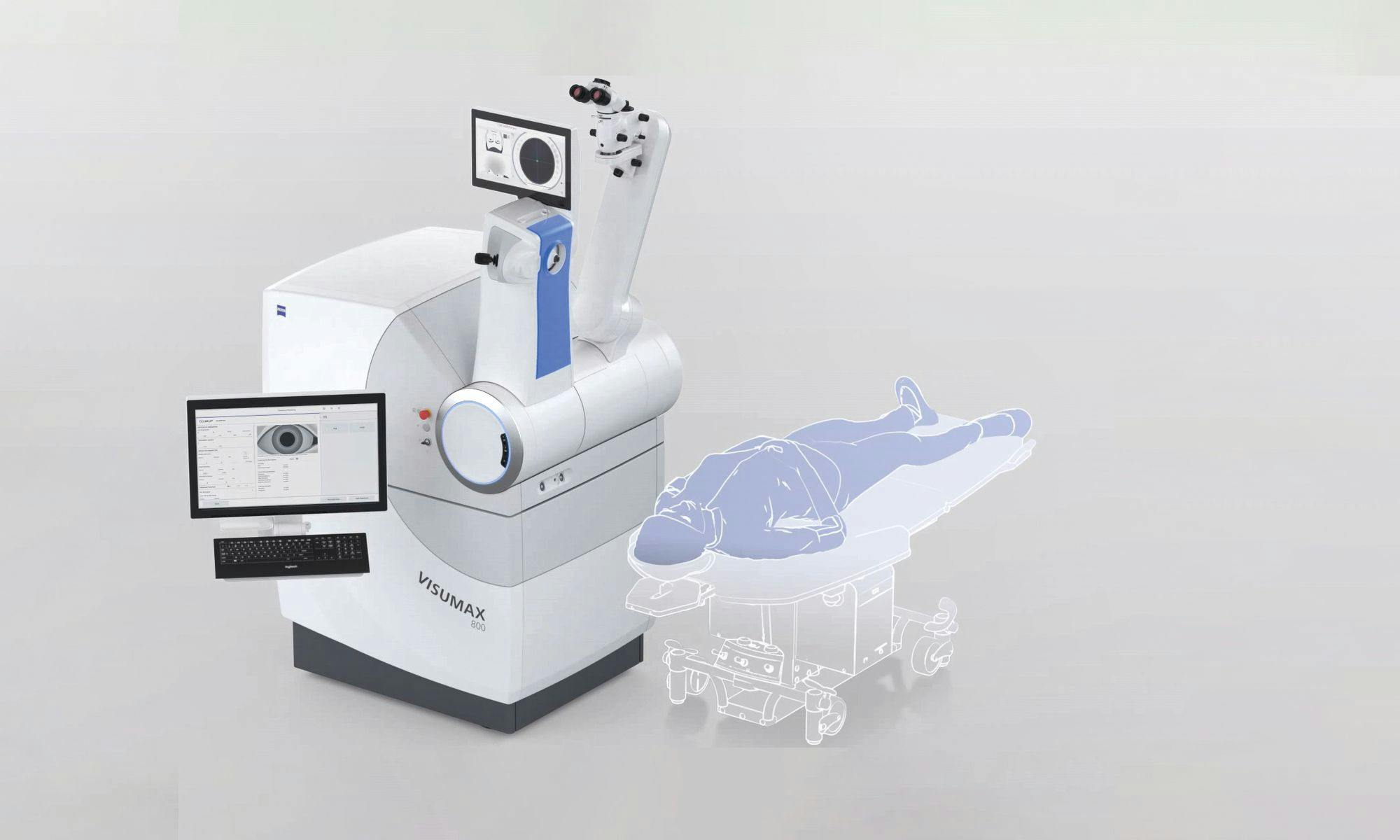 SMILE for myopia and myopic astigmatism – Increasing procedural ease and efficiency with the VISUMAX 800 femtosecond laser