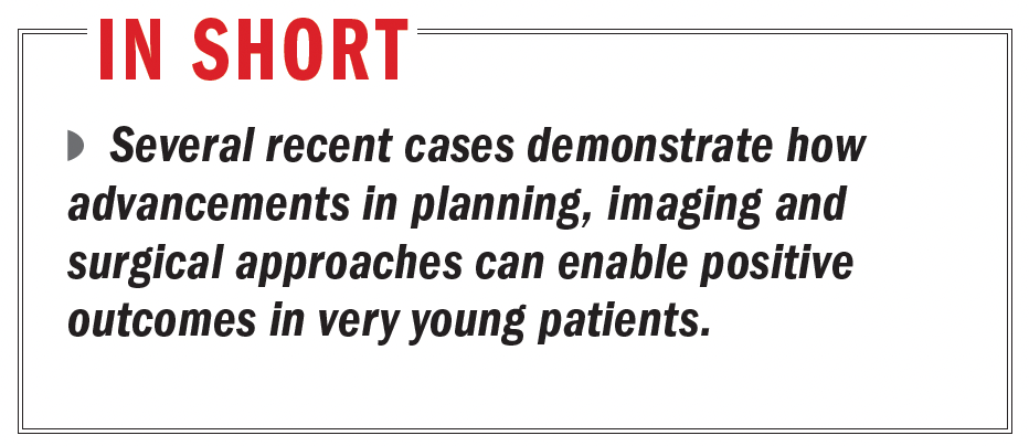Several recent cases demonstrate how advancements in planning, imaging and surgical approaches can enable positive outcomes in very young patients.