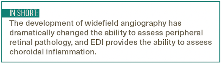 Pull quote text reads: The development of widefield angiography has dramatically changed the ability to assess peripheral retinal pathology, and EDI provides the ability to assess choroidal inflammation.