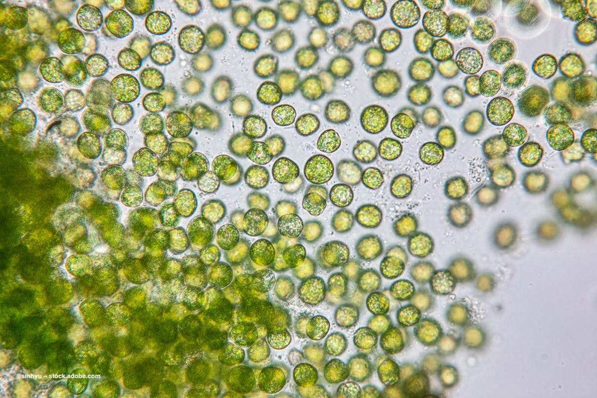 Algae cells are bright green underneath a microscope. Image credit: ©sinhyu – stock.adobe.com