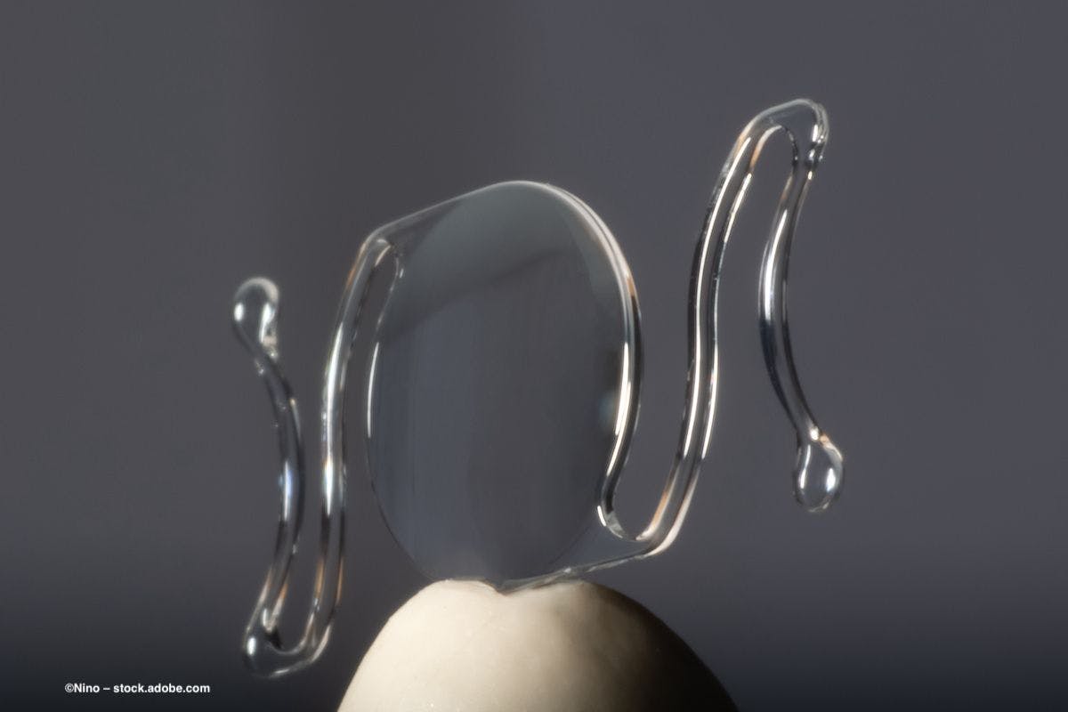 An intraocular lens, balanced on a finger. Image credit: ©Nino – stock.adobe.com