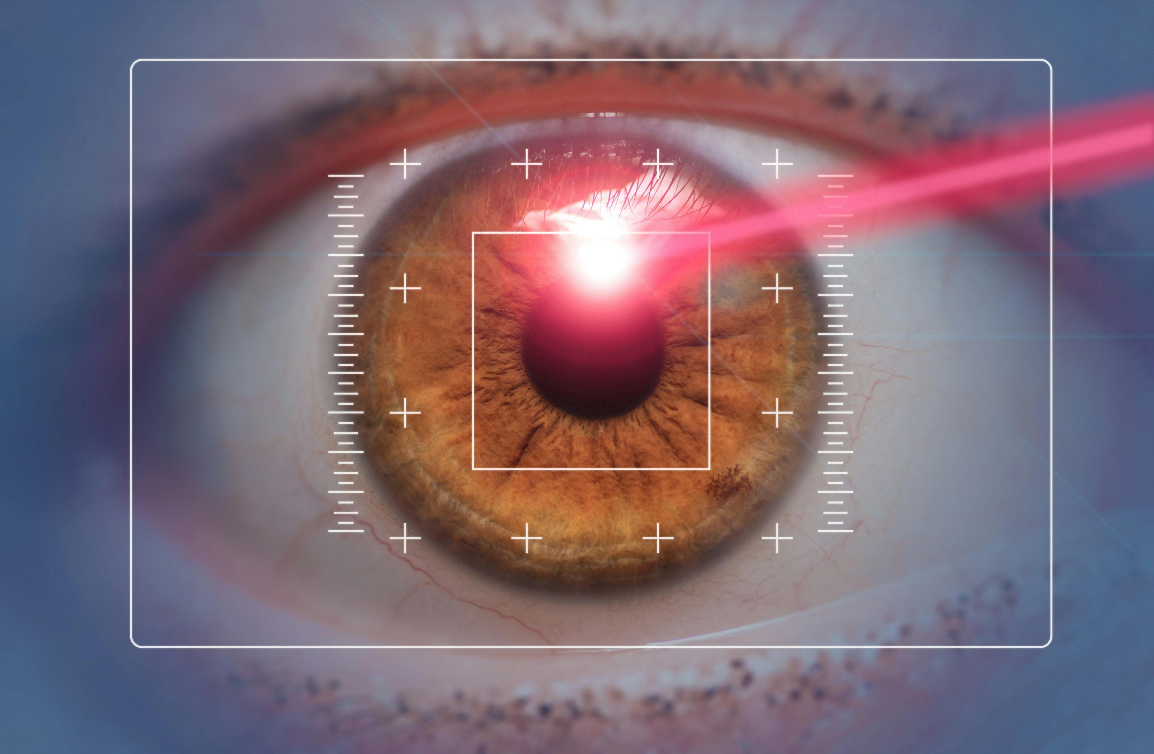 close up of eye with laser beam