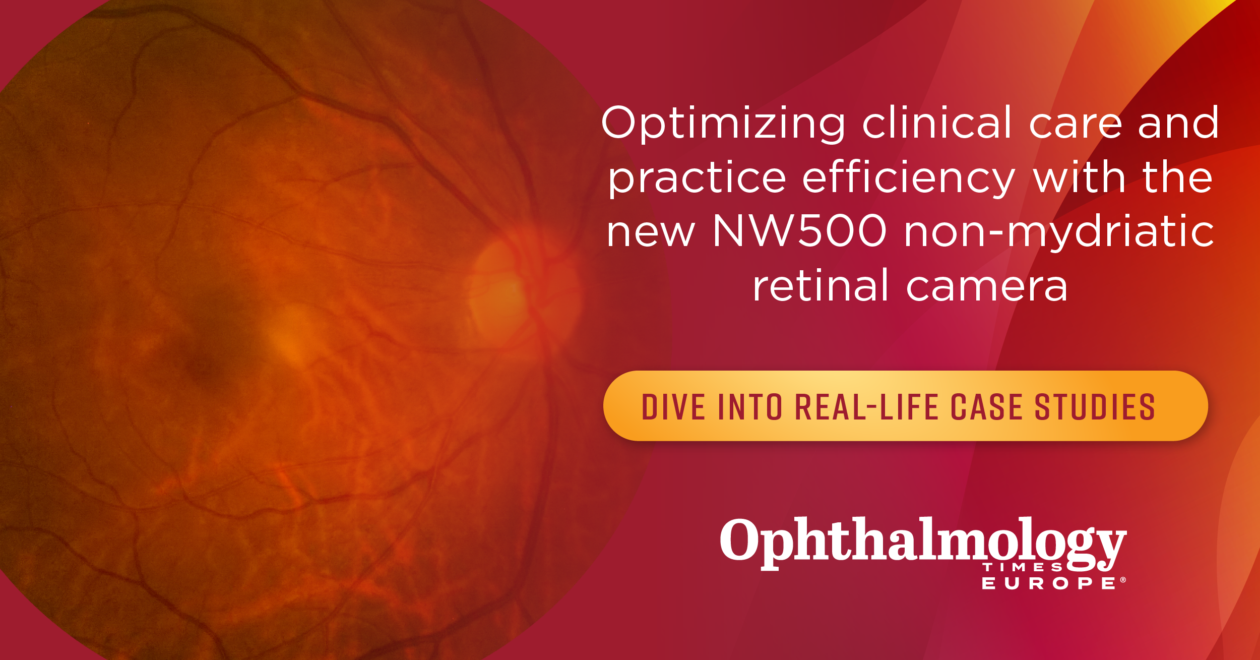HORIZONS IN FUNDUS IMAGING: Enhancing reliability, quality, and workflow efficiency with the NW500 non-mydriatic retinal camera
