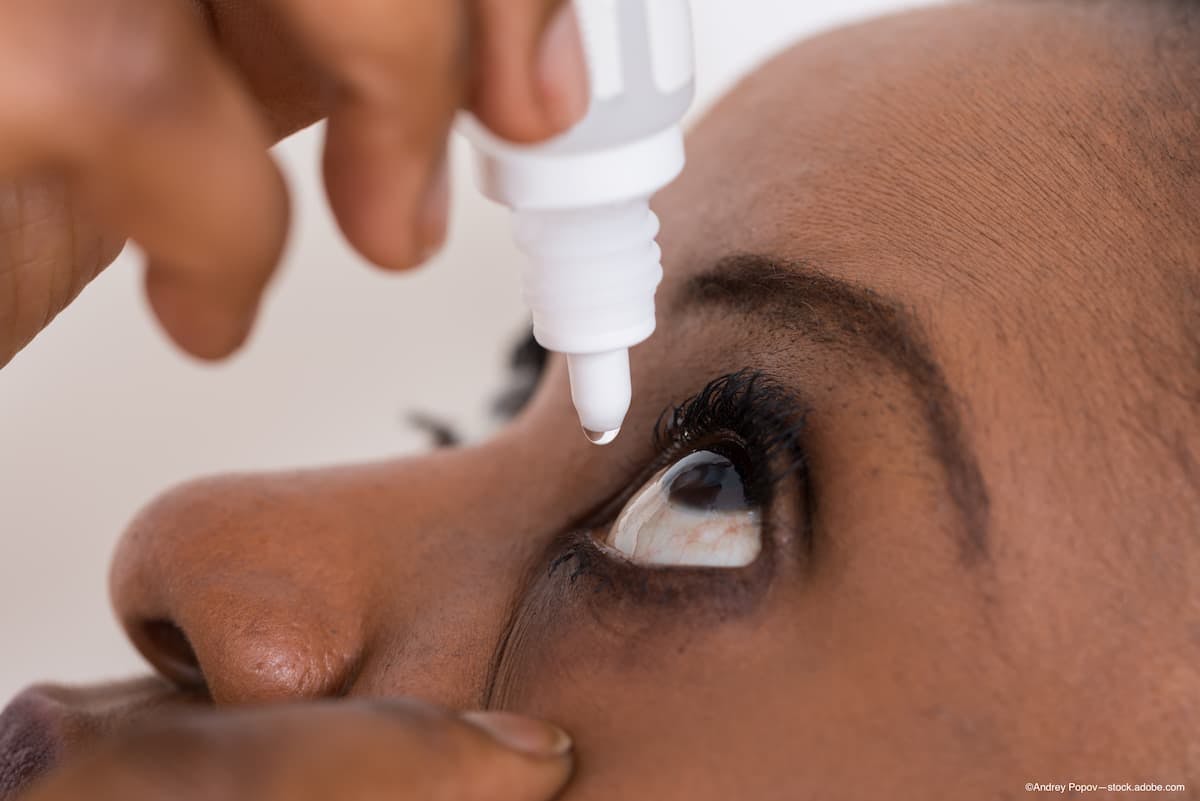 Dry eye disease causes imbalance of neuropeptides, neurotrophins in cornea, trigeminal ganglion