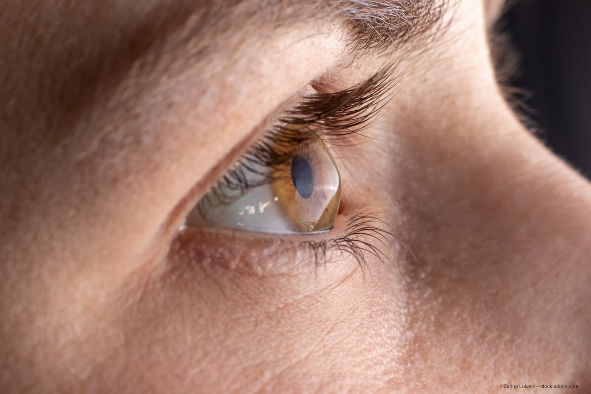 Maximising corneal cross-linking effectiveness