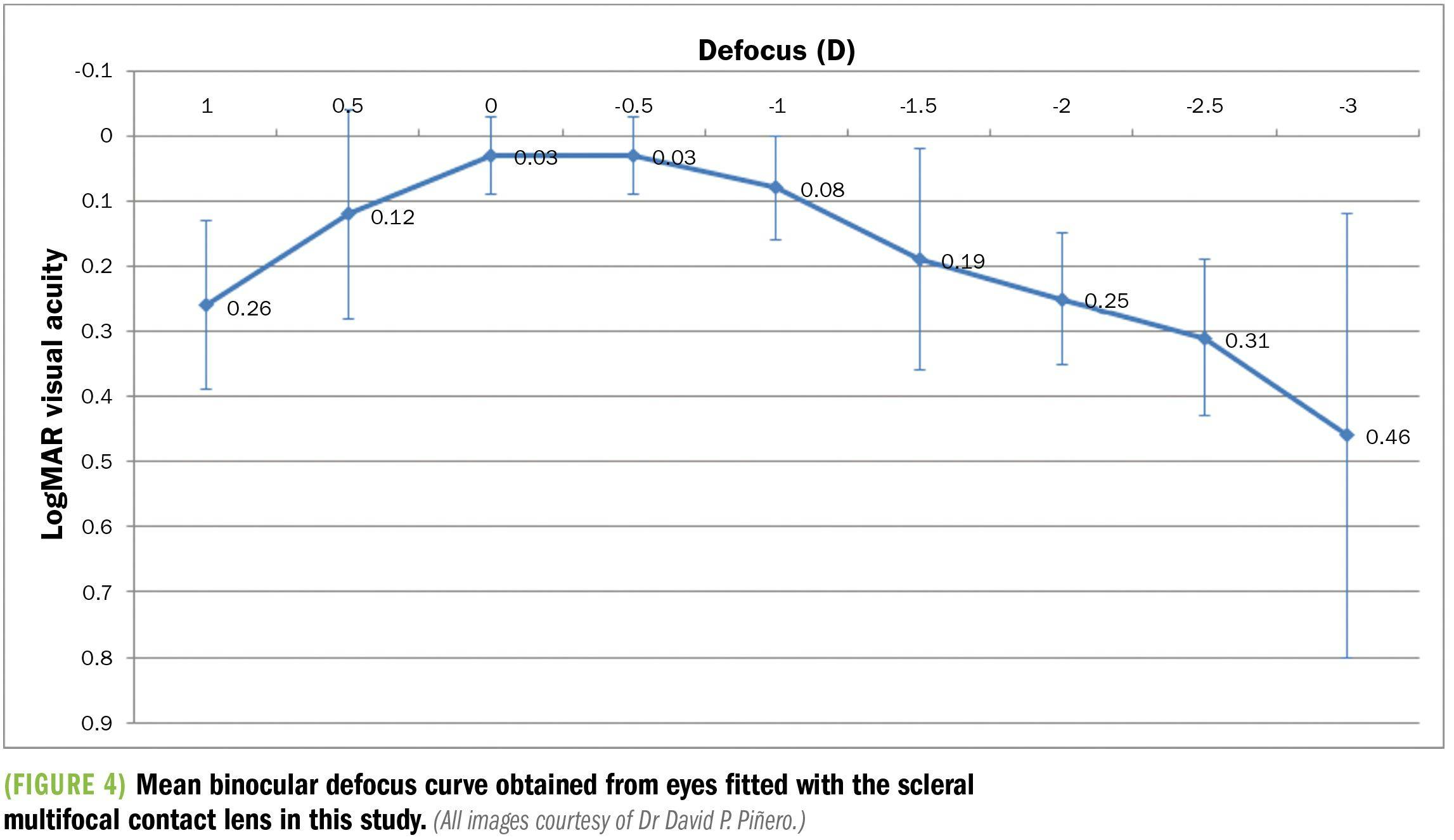 Mean binocular defocus curve obtained from eyes fitted with the scleral multifocal contact lens in this study