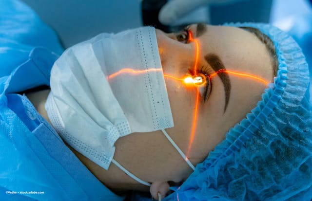 A patient undergoes laser eye surgery. Image credit: ©Vadim – stock.adobe.com