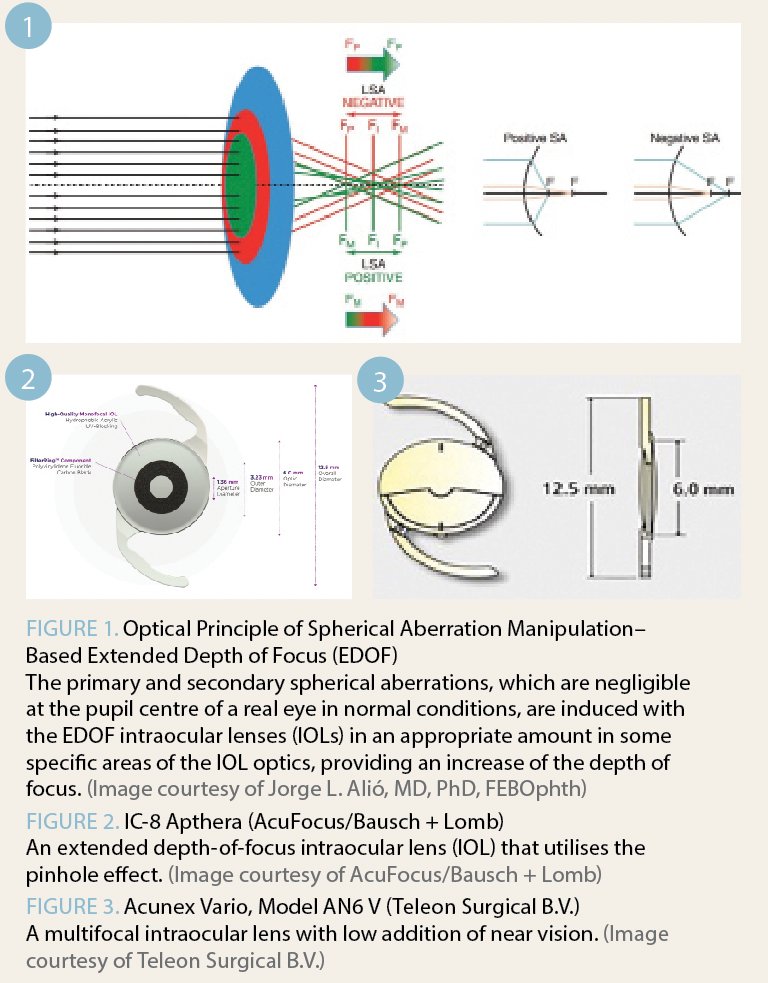 Figures demonstrate the Optical Principle of Spherical Aberration Manipulation–Based Extended Depth of Focus (EDOF) 