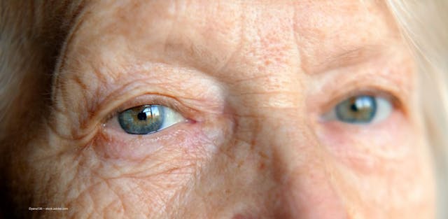 A person with wrinkles looks directly at the camera. They have blue eyes. Image credit: ©yana136 – stock.adobe.com