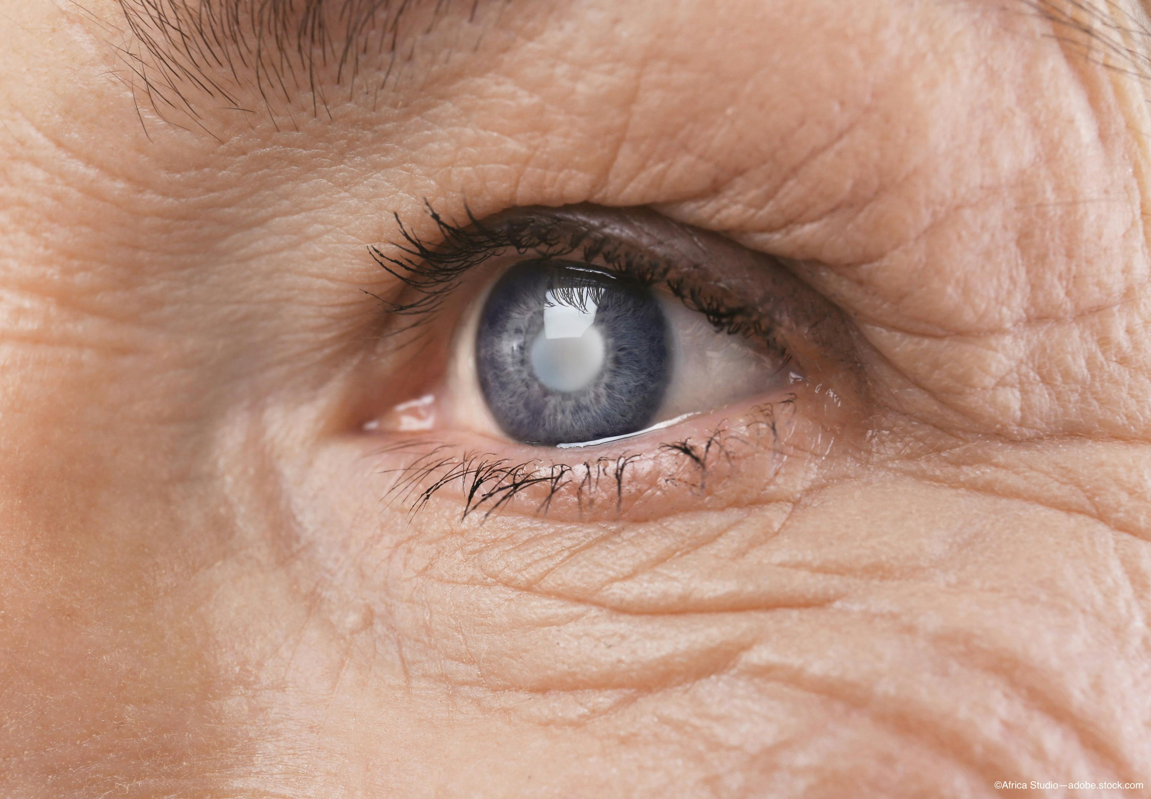 Using pivotal study data to guide glaucoma patient management decisions