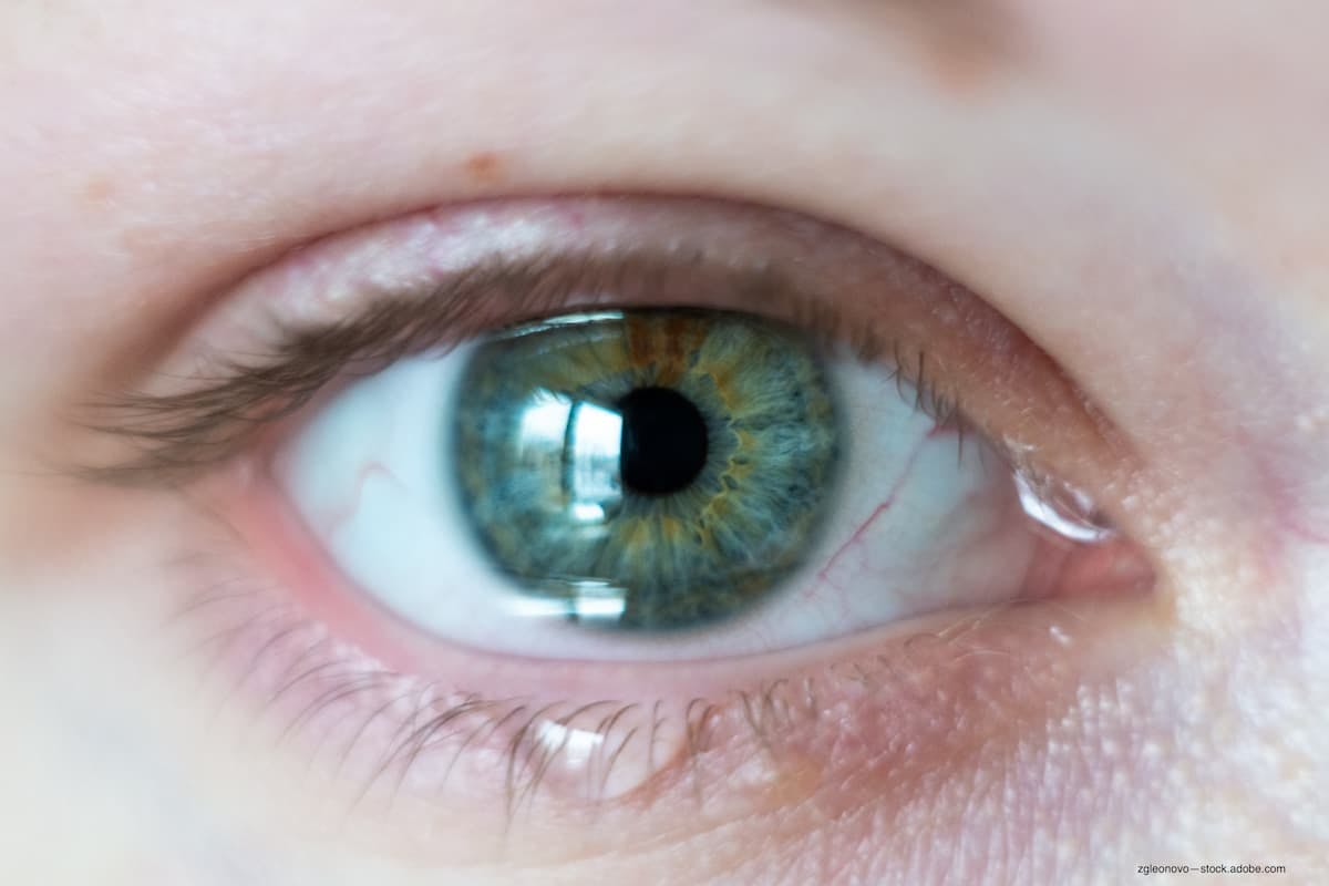 Dextenza approval in US provides new allergic conjunctivitis option