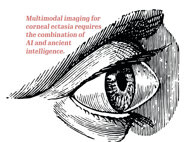 Multimodal imaging for corneal ectasia requires the combination of AI and ancient intelligence