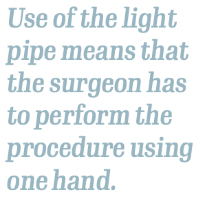 Use of the light pipe means that the surgeon has to perform the procedure using one hand.