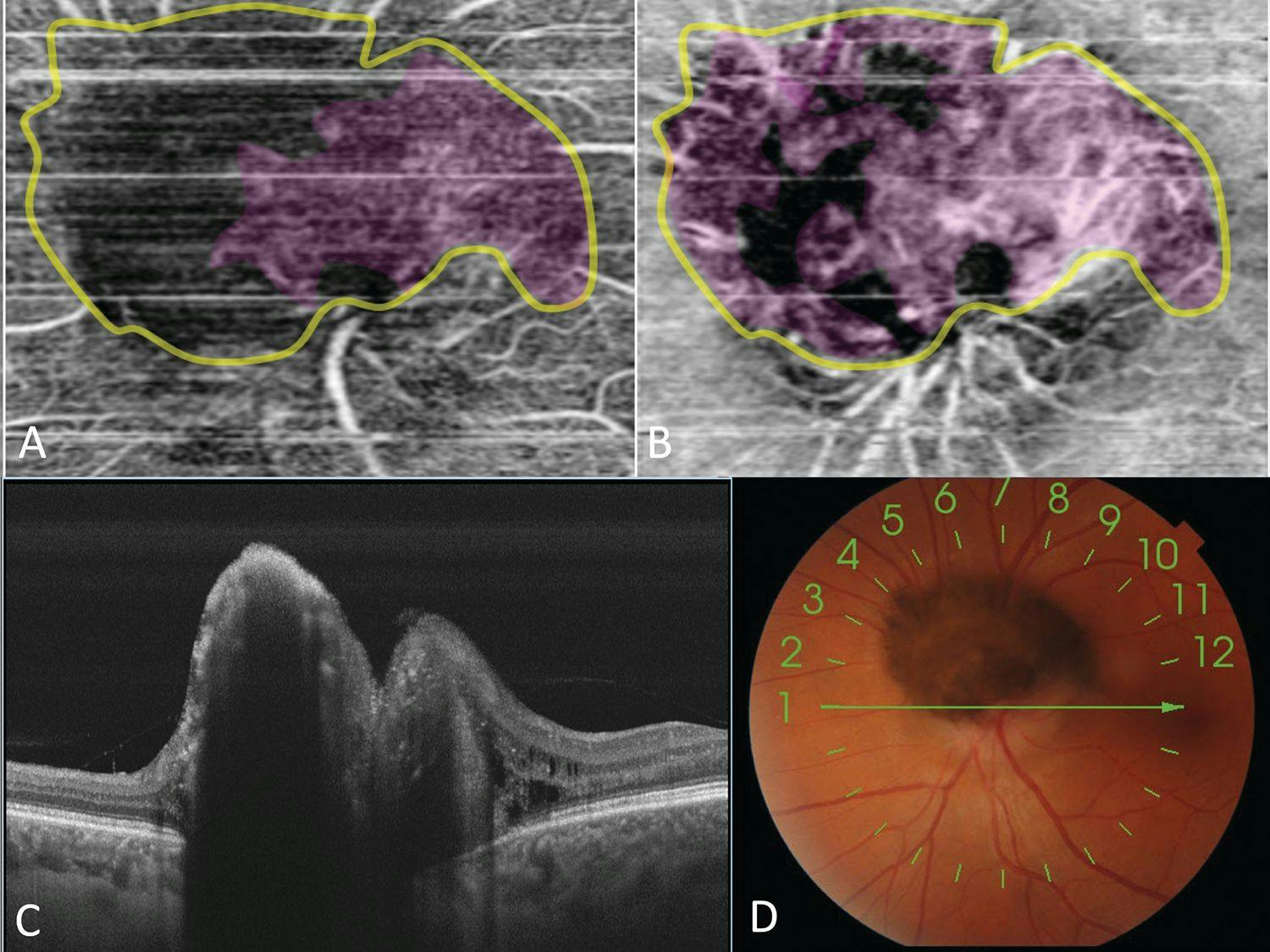 Images of deep tissues of the eye
