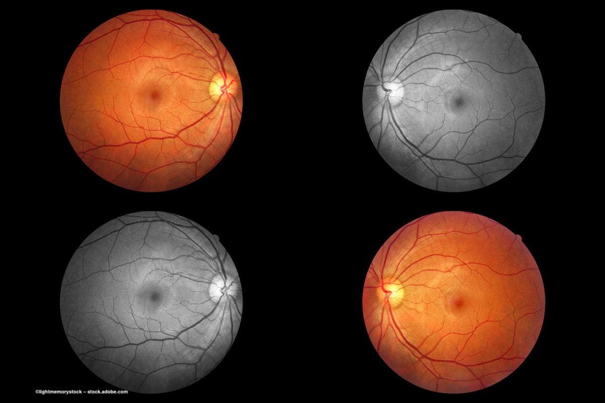 Four different images show the retina of the eye. Image credit: ©lightmemorystock – stock.adobe.com