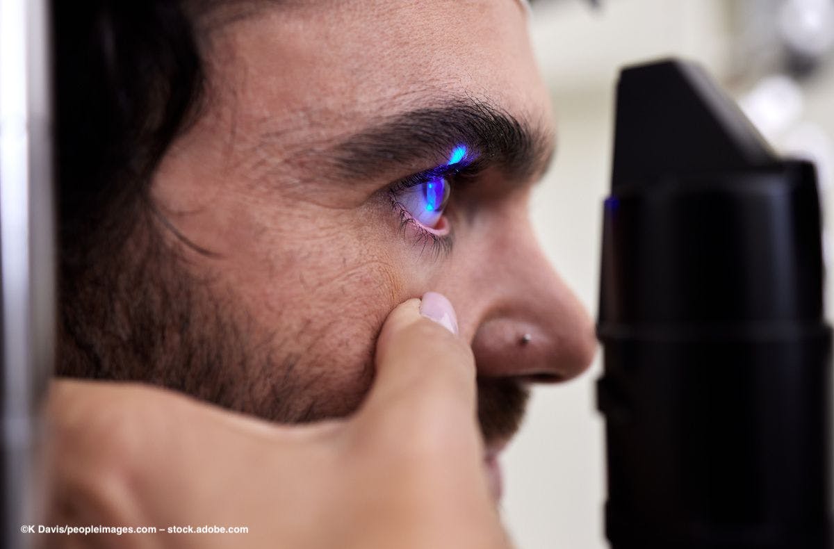 A man's eye is examined with a laser tool. Image credit: ©K Davis/peopleimages.com – stock.adobe.com