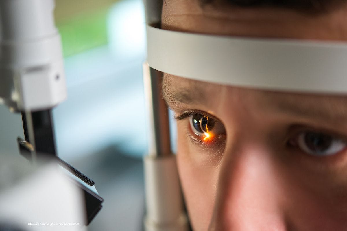 A light shines into a patient's eye in an ophthalmic device. Image credit: ©Анна Ковальчук – stock.adobe.com