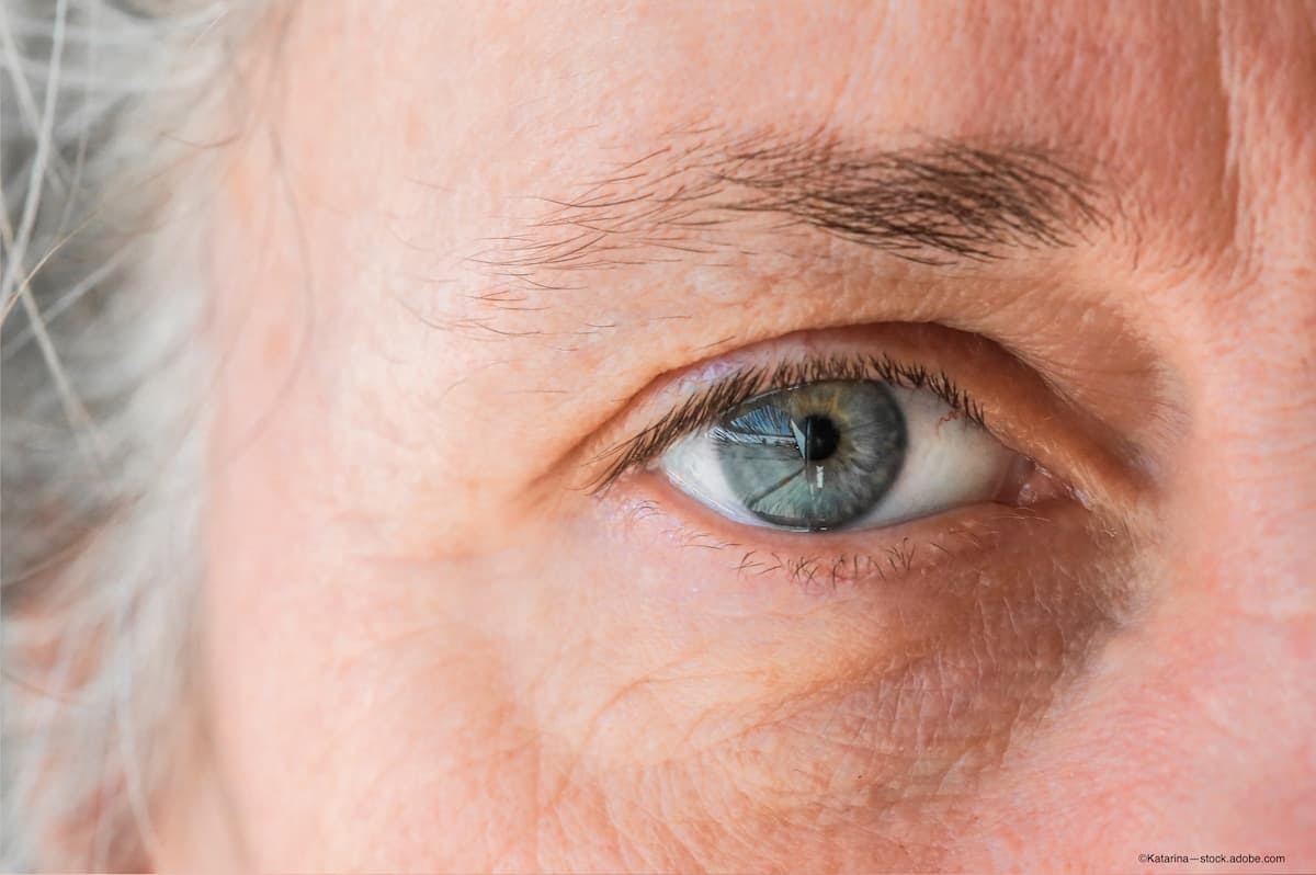 Researchers find association between glaucoma and chronic kidney disease