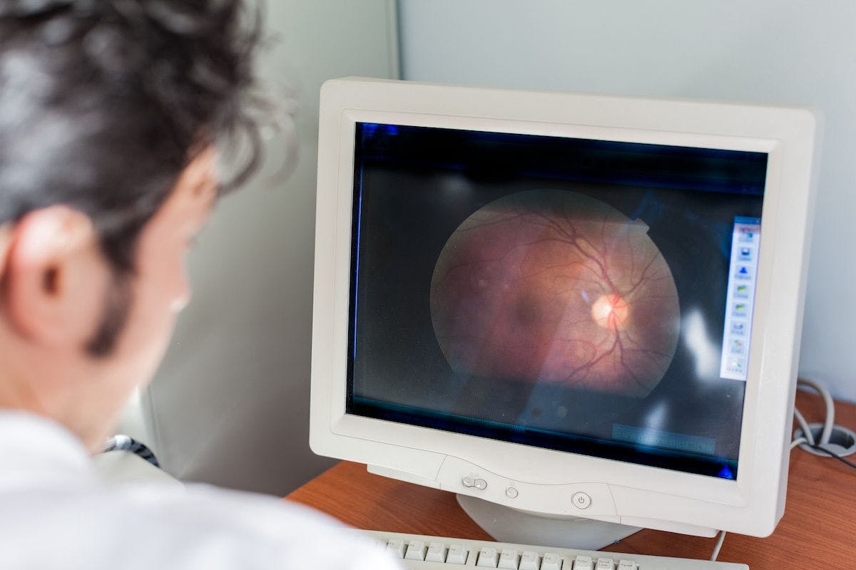 A physician looks at a retinal image on a computer screen. Image credit: ©Dario Lo Presti –  stock.adobe.com