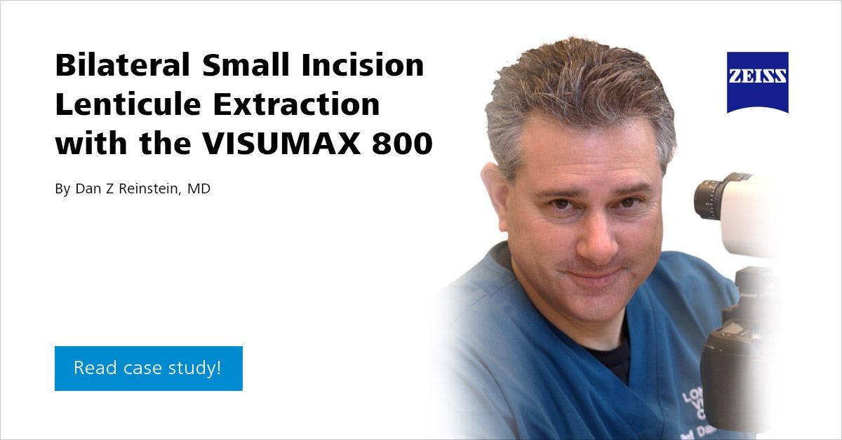 Bilateral Small Incision Lenticule Extraction with SMILE pro using the VISUMAX 800
