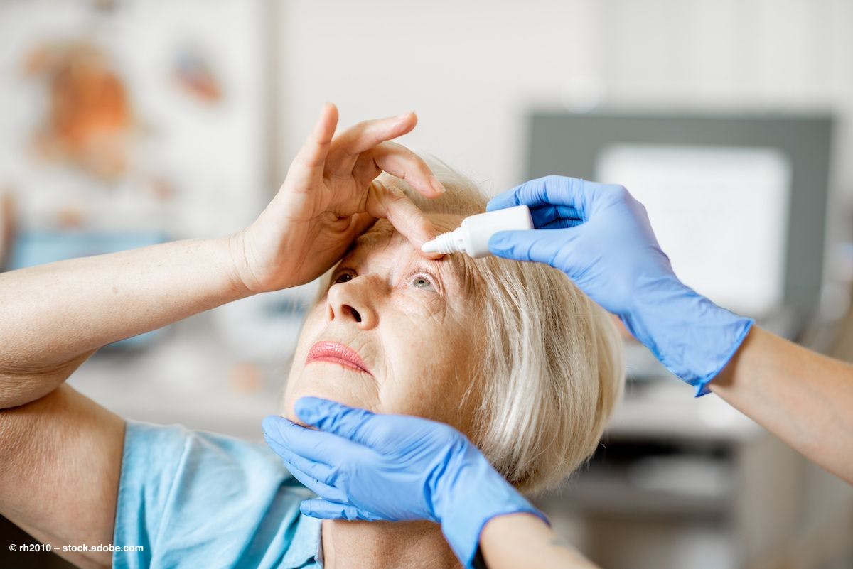 A doctor's gloved hands administer eye drops in a female patient's eye. Image credit: ©rh2010 – stock.adobe.com