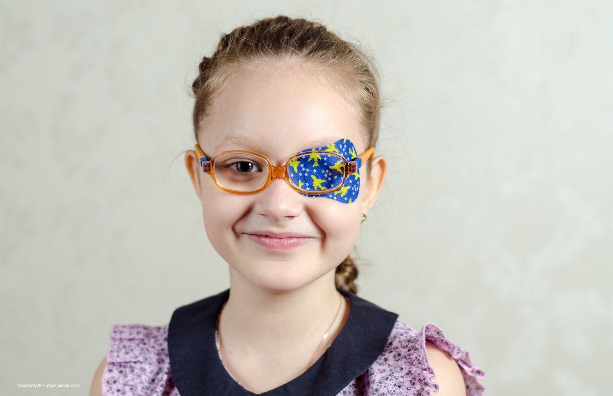 A young girl with glasses and a patch over one eye to correct amblyopia. Image credit: ©sasha1806 – stock.adobe.com