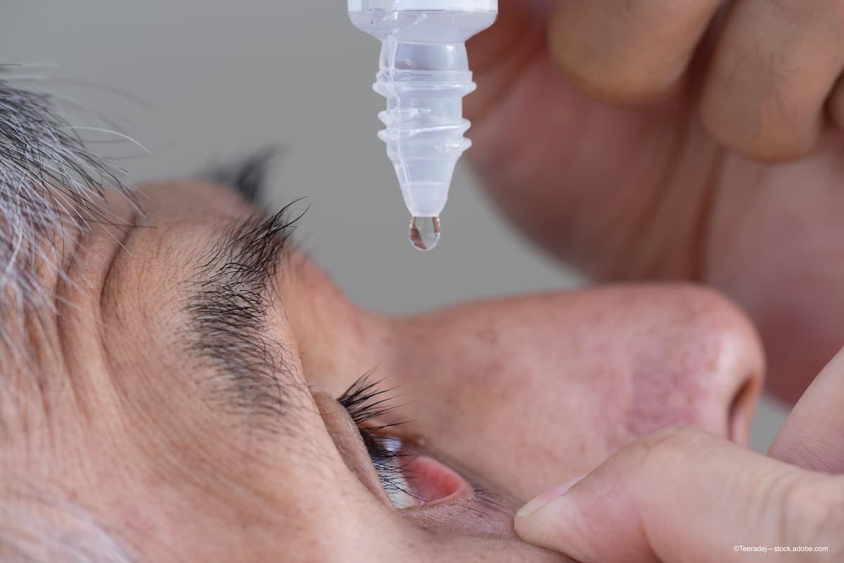 Selecting the right topical glaucoma therapy is important