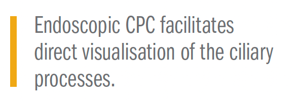 Endoscopic CPC facilitates direct visualisation of the ciliary processes