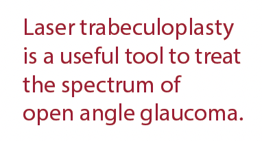 Text: Laser trabeculoplasty  is a useful tool to treat the spectrum of  open angle glaucoma.