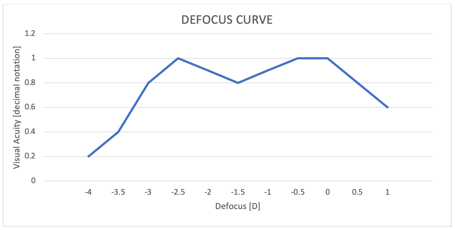 Figure 2. Binocular defocus curve from my first patient shows good visual acuity (decimal 0.8 to 1.0) is achieved from far through intermediate to near distances.