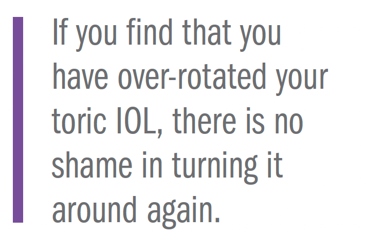If you find that you have over-rotated your toric IOL, there is no shame in turning it around again.
