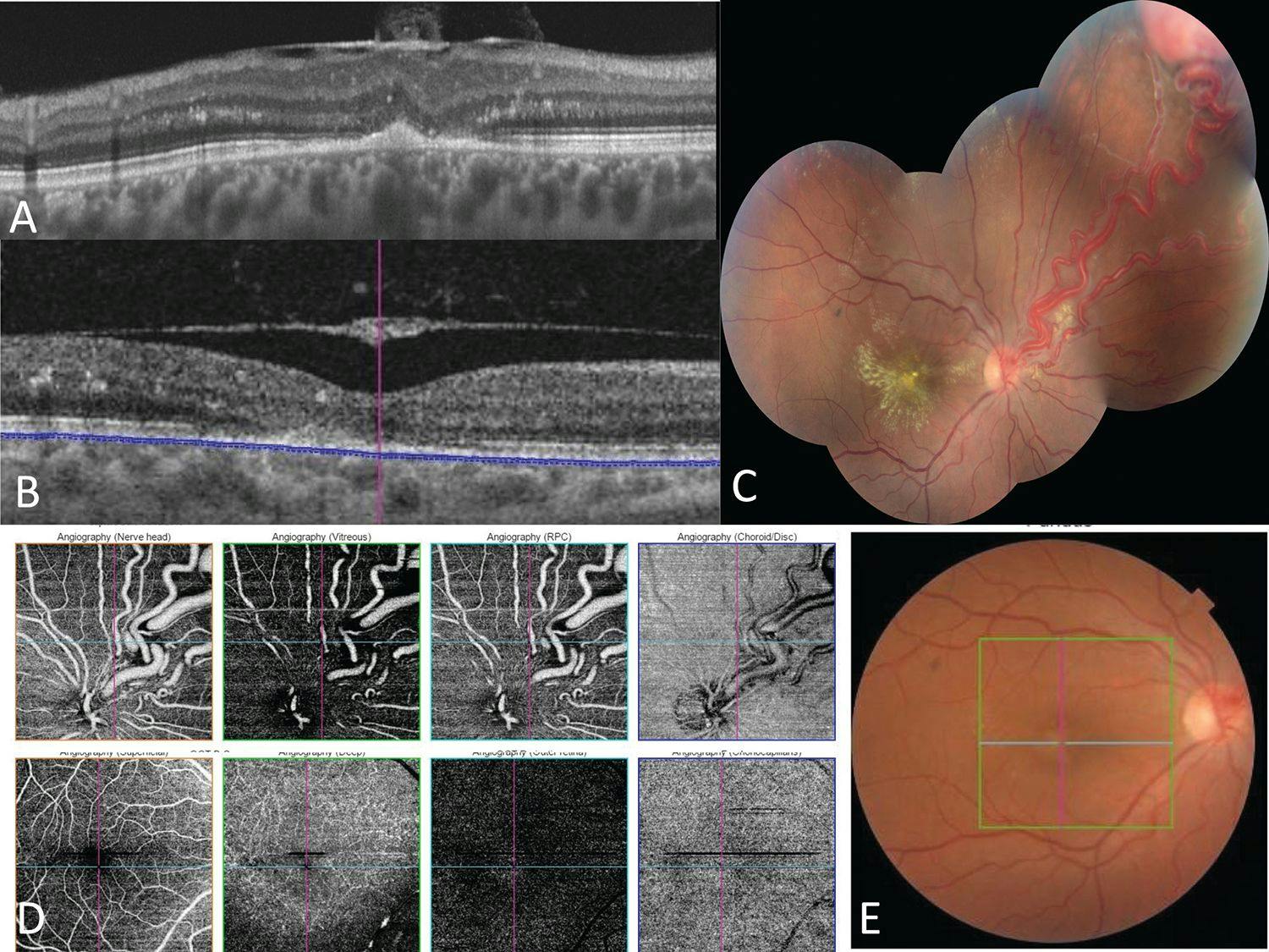 Images of deep tissues of the eye