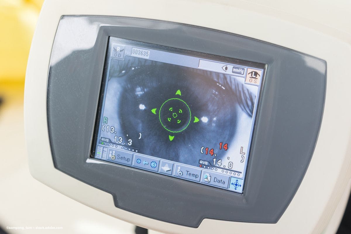 An imaging device shows intraocular pressure. Image Credit: ©sompong_tom – stock.adobe.com