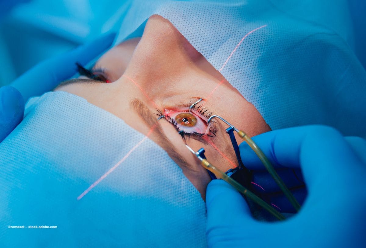 A physician performs laser surgery on a person's eye. Image credit: ©romaset – stock.adobe.com