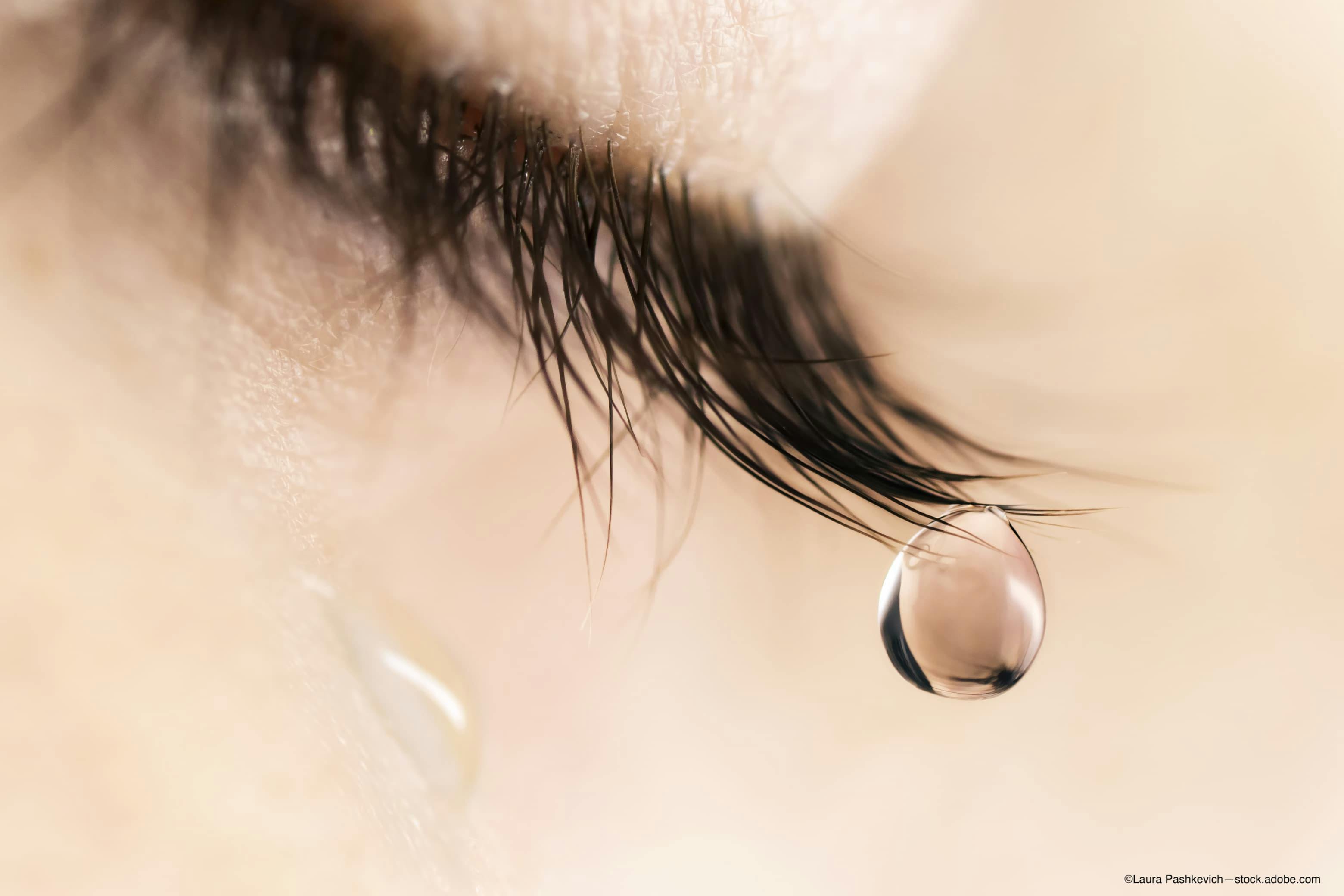 Austrian study targets dry eye disease in postmenopausal women