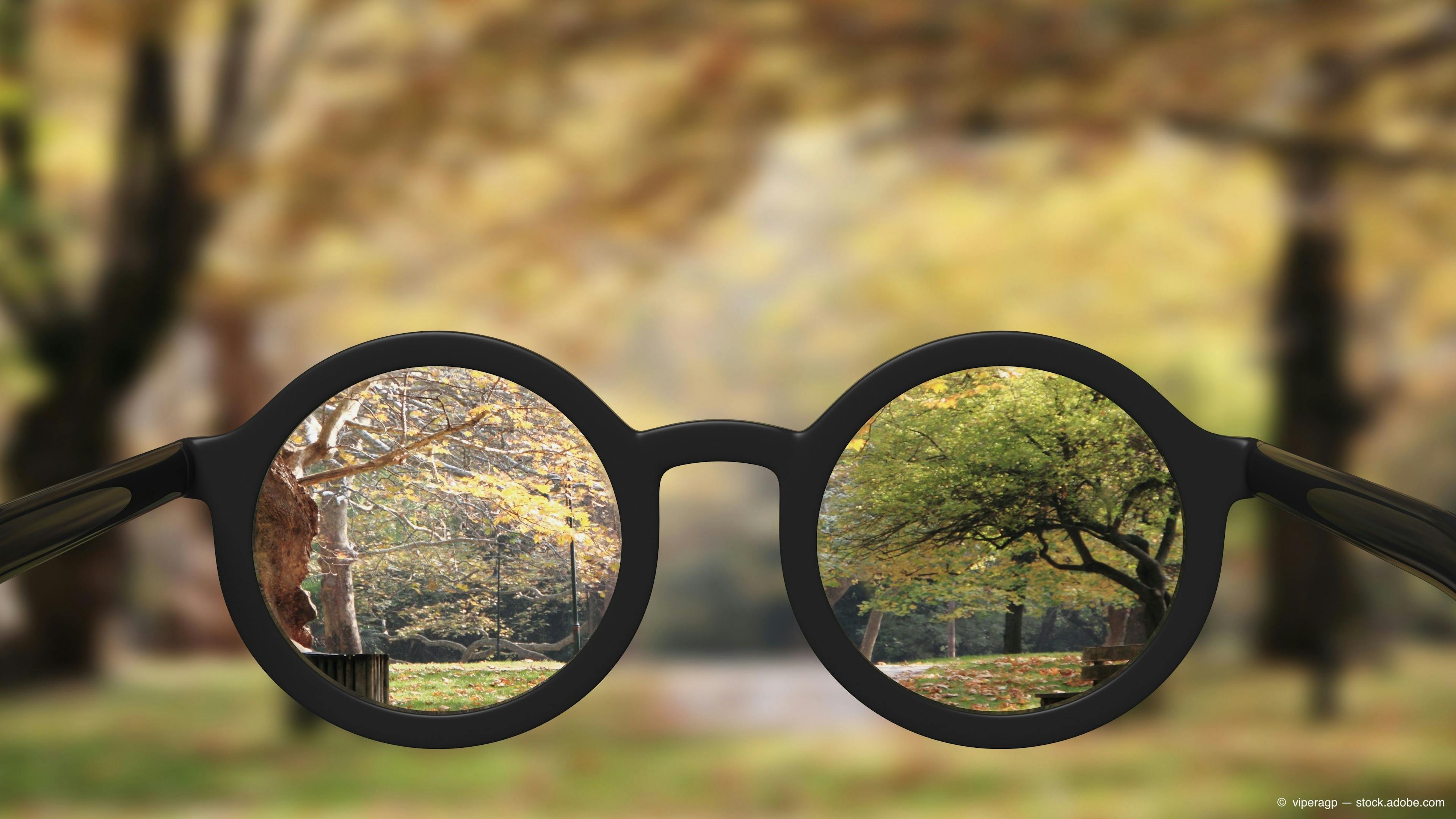 AAO: Myopia progression slowed with orthokeratology, multifocal lenses 